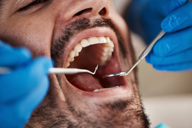 Best Chipped Tooth Repair Near Me  in Toledo, IL