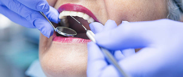 Best Teeth Whitening  in Toledo, IL